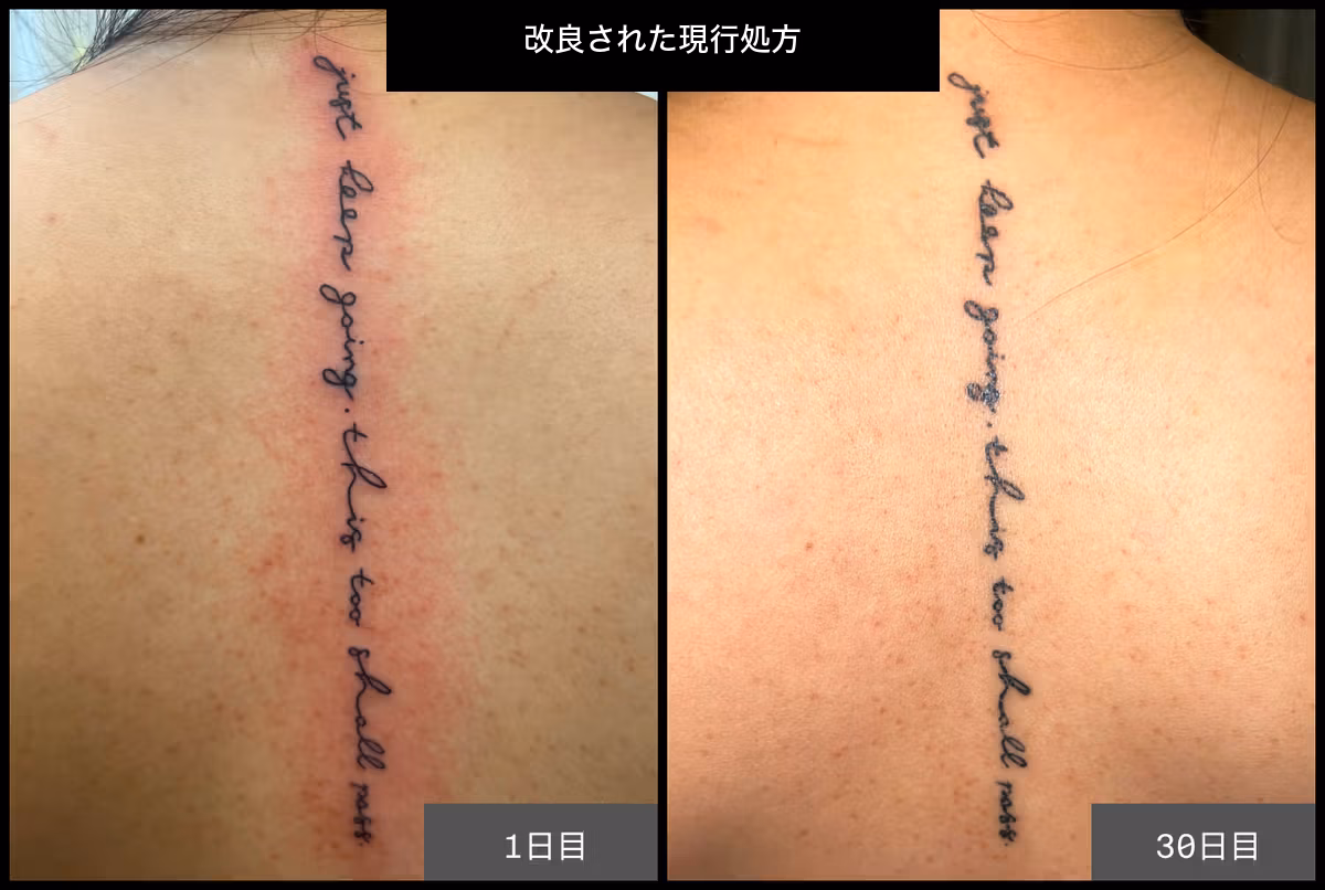 改良された現行処方の施術直後と約30日後を比較したメーカー提供画像
